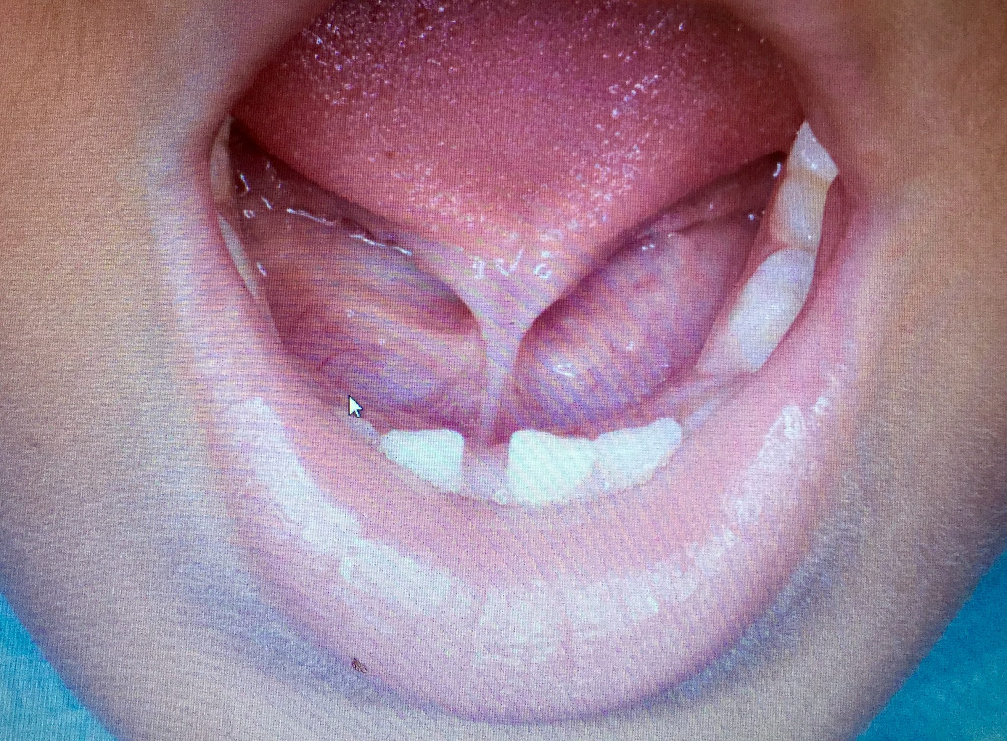 舌ちゃんと動きますか 市川市行徳駅からすぐの歯医者 行徳tm歯科