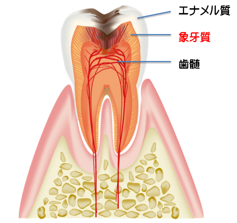 歯 の 神経 炎症